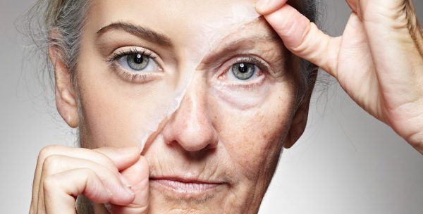 Peeling de Fenol profundo